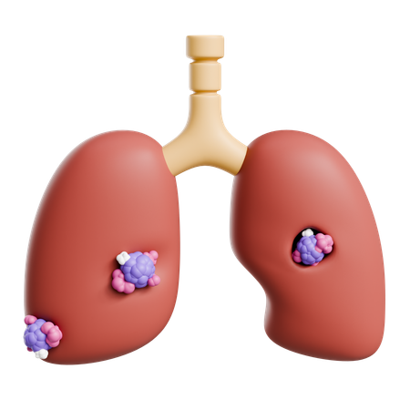 Lung Cancer  3D Icon