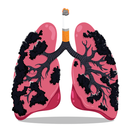 Damaged lungs due to smoking  Illustration