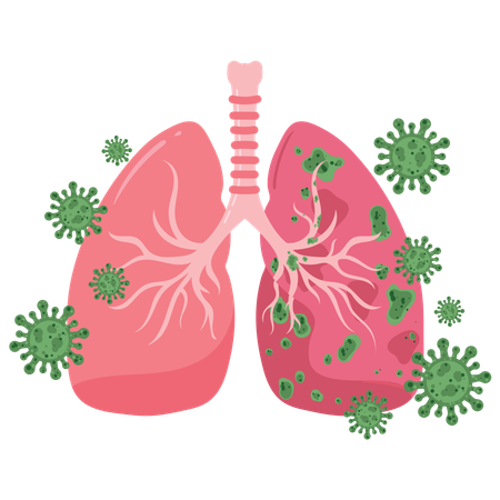 Lung Defence  Immune System Protection Against Virus Attack  Illustration