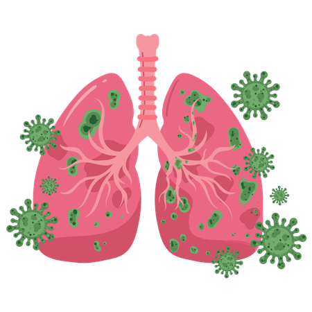 Lung Defence  Immune System Protection Against Virus Attack  Illustration